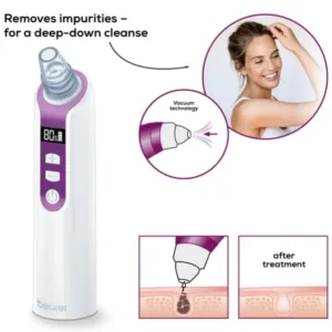 Beurer Blackhead Remover with Suction Technology